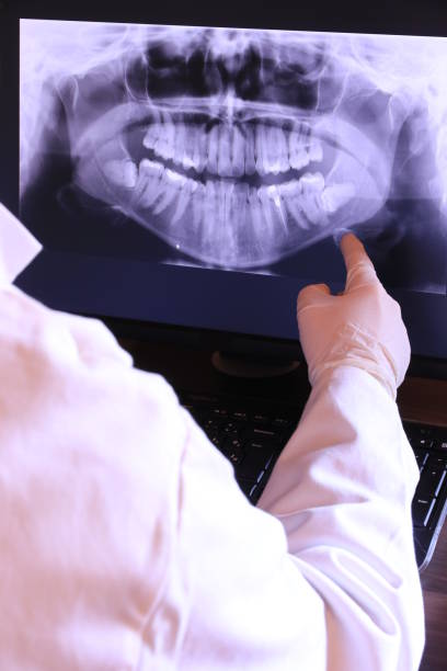 Best Emergency Tooth Extraction in Cumberland, KY
