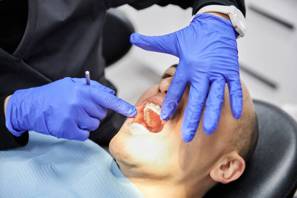 Best Emergency Gum Treatment in Cumberland, KY